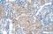 Sep (O-phosphoserine) tRNA:Sec (Selenocysteine) tRNA synthase antibody, NBP1-57253, Novus Biologicals, Immunohistochemistry frozen image 