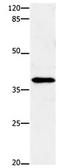 Ectonucleotide Pyrophosphatase/Phosphodiesterase 7 antibody, orb107506, Biorbyt, Western Blot image 
