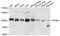 Karyopherin Subunit Beta 1 antibody, A8610, ABclonal Technology, Western Blot image 