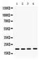 NME/NM23 Nucleoside Diphosphate Kinase 1 antibody, PA5-79743, Invitrogen Antibodies, Western Blot image 