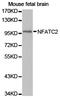 Nuclear Factor Of Activated T Cells 2 antibody, TA327519, Origene, Western Blot image 