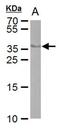 Cre Recombinase antibody, MA5-27870, Invitrogen Antibodies, Western Blot image 