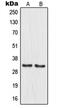 Mitochondrial Ribosomal Protein L19 antibody, MBS821769, MyBioSource, Western Blot image 