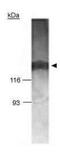 AT-Rich Interaction Domain 4B antibody, GTX30623, GeneTex, Western Blot image 