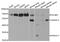 PDZ And LIM Domain 5 antibody, MBS2523229, MyBioSource, Western Blot image 