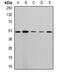 StAR Related Lipid Transfer Domain Containing 3 antibody, abx142248, Abbexa, Western Blot image 