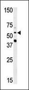 N-Myristoyltransferase 2 antibody, PA5-12208, Invitrogen Antibodies, Western Blot image 