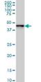 Zinc Finger Protein 24 antibody, H00007572-M01, Novus Biologicals, Western Blot image 