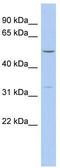 F-Box Protein 15 antibody, TA338901, Origene, Western Blot image 