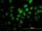 Protein Geranylgeranyltransferase Type I Subunit Beta antibody, H00005229-M02, Novus Biologicals, Immunocytochemistry image 