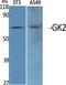 Glycerol Kinase 2 antibody, A11596, Boster Biological Technology, Western Blot image 