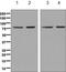 Methylmalonyl-CoA mutase, mitochondrial antibody, ab134956, Abcam, Western Blot image 