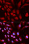 Ubiquitin Like With PHD And Ring Finger Domains 1 antibody, A01156, Boster Biological Technology, Chromatin Immunoprecipitation image 