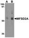Major Facilitator Superfamily Domain Containing 2A antibody, orb75514, Biorbyt, Western Blot image 