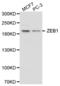 Zinc Finger E-Box Binding Homeobox 1 antibody, abx001268, Abbexa, Western Blot image 