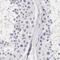 Ornithine Carbamoyltransferase antibody, PA5-51366, Invitrogen Antibodies, Immunohistochemistry paraffin image 