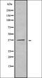 Olfactory Receptor Family 51 Subfamily F Member 2 antibody, orb378357, Biorbyt, Western Blot image 