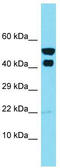 IKBKB Interacting Protein antibody, TA337353, Origene, Western Blot image 