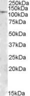 Inosine Monophosphate Dehydrogenase 2 antibody, 46-966, ProSci, Western Blot image 