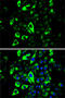 Sequestosome 1 antibody, LS-C746921, Lifespan Biosciences, Immunofluorescence image 