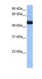 Phosphatidylinositol Glycan Anchor Biosynthesis Class K antibody, orb324878, Biorbyt, Western Blot image 