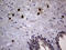 Proteinase 3 antibody, LS-C794034, Lifespan Biosciences, Immunohistochemistry paraffin image 