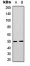 Solute Carrier Family 16 Member 3 antibody, orb304587, Biorbyt, Western Blot image 