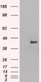 Sorting Nexin 16 antibody, orb18458, Biorbyt, Western Blot image 
