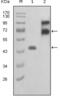 Fibulin 2 antibody, abx012116, Abbexa, Enzyme Linked Immunosorbent Assay image 