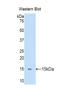 Lysyl Oxidase Like 2 antibody, LS-C295245, Lifespan Biosciences, Western Blot image 