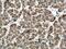Aldehyde Dehydrogenase 5 Family Member A1 antibody, 17319-1-AP, Proteintech Group, Immunohistochemistry paraffin image 