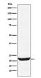 Neuronal Calcium Sensor 1 antibody, M05330, Boster Biological Technology, Western Blot image 