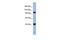 Argonaute RISC Component 4 antibody, GTX44813, GeneTex, Western Blot image 