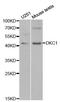 Dyskerin Pseudouridine Synthase 1 antibody, orb48353, Biorbyt, Western Blot image 