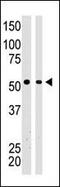 BAI1 Associated Protein 2 antibody, PA5-15497, Invitrogen Antibodies, Western Blot image 