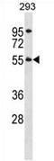 Tetratricopeptide Repeat Domain 8 antibody, AP54402PU-N, Origene, Western Blot image 