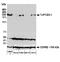 Tight Junction Protein 1 antibody, A700-092, Bethyl Labs, Western Blot image 
