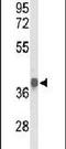 Pyruvate Dehydrogenase E1 Alpha 1 Subunit antibody, PA5-26656, Invitrogen Antibodies, Western Blot image 