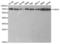 Checkpoint Kinase 2 antibody, LS-C331943, Lifespan Biosciences, Western Blot image 