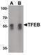 Transcription Factor EB antibody, PA5-34360, Invitrogen Antibodies, Western Blot image 