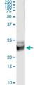 RAB7B, Member RAS Oncogene Family antibody, H00338382-M01, Novus Biologicals, Immunoprecipitation image 