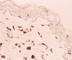 Mannose Receptor antibody, DDX0380P-100, Novus Biologicals, Western Blot image 