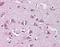 Neurofibromin 2 antibody, orb88132, Biorbyt, Immunohistochemistry paraffin image 