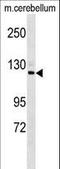 Semaphorin-6D antibody, LS-C168958, Lifespan Biosciences, Western Blot image 