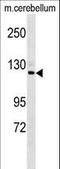 Semaphorin 6D antibody, LS-C168958, Lifespan Biosciences, Western Blot image 