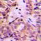 Ubiquitin Conjugating Enzyme E2 E3 antibody, orb234976, Biorbyt, Immunohistochemistry paraffin image 
