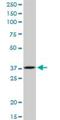 Ribose 5-Phosphate Isomerase A antibody, H00022934-B01P, Novus Biologicals, Western Blot image 