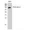 Protein Phosphatase 2 Regulatory Subunit B'Delta antibody, LS-C385606, Lifespan Biosciences, Western Blot image 