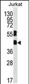 MAF BZIP Transcription Factor B antibody, PA5-71660, Invitrogen Antibodies, Western Blot image 