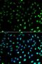 S100 Calcium Binding Protein A8 antibody, orb48527, Biorbyt, Immunofluorescence image 